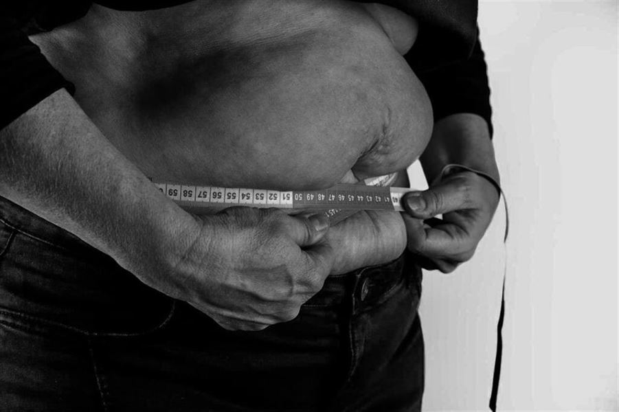 Vægttab hypnose i Vejle hjælper dig med at bryde gamle mønstre